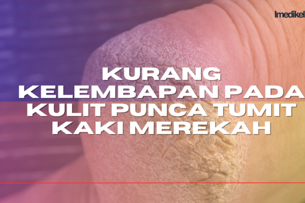 KURANG KELEMBAPAN PADA KULIT PUNCA TUMIT KAKI MEREKAH